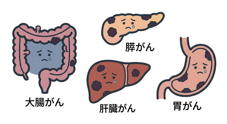 胃がん　大腸がん　肺臓がん　膵がん